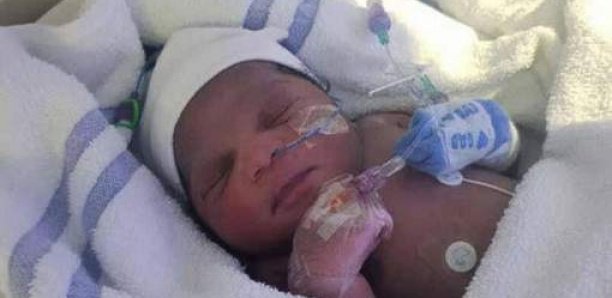 Anomalies congénitales : 303 000 nouveau-nés meurent par an
