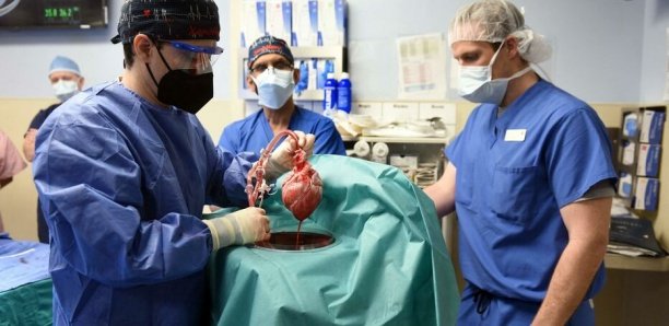 Greffe de cœur d'un porc génétiquement modifié : David Bennett décède deux mois après son opération Greffe de cœur d'un porc génétiquement modifié : David Bennett décède deux mois après son opération