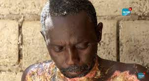 Guédiawaye / Grièvement brûlé, Babacar se meurt à petit feu (Ames sensibles s'abstenir) Guédiawaye / Grièvement brûlé, Babacar se meurt à petit feu (Ames sensibles s'abstenir)