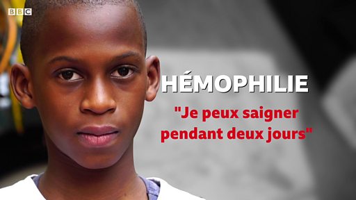 LUTTE CONTRE L’HÉMOPHILIE Sur les 1 700 cas attendus, seuls 340 sont dépistés LUTTE CONTRE L’HÉMOPHILIE Sur les 1 700 cas attendus, seuls 340 sont dépistés