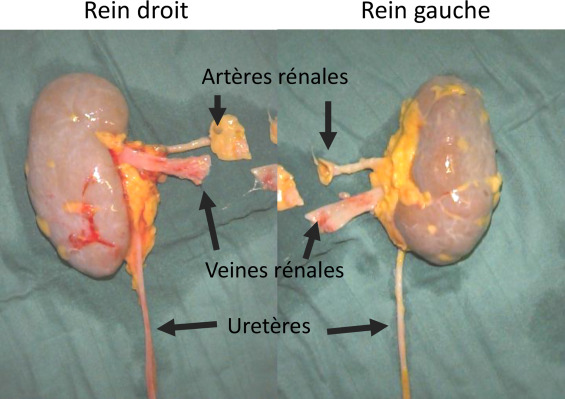 Santé : Plus de 25 millions FCfa pour se faire transplanter un rein Santé : Plus de 25 millions FCfa pour se faire transplanter un rein