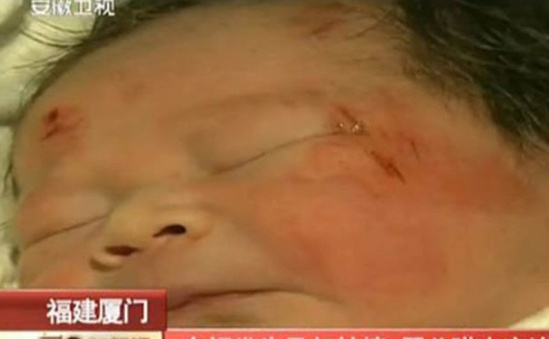 CHINE -  un bébé expulsé du ventre de sa mère lors d'un accident de la route ?