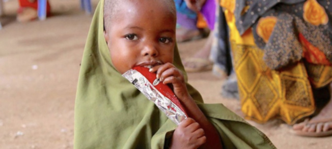 Une explosion catastrophique des taux de malnutrition sévère chez les enfants menace le monde, selon l’UNICEF Une explosion catastrophique des taux de malnutrition sévère chez les enfants menace le monde, selon l’UNICEF