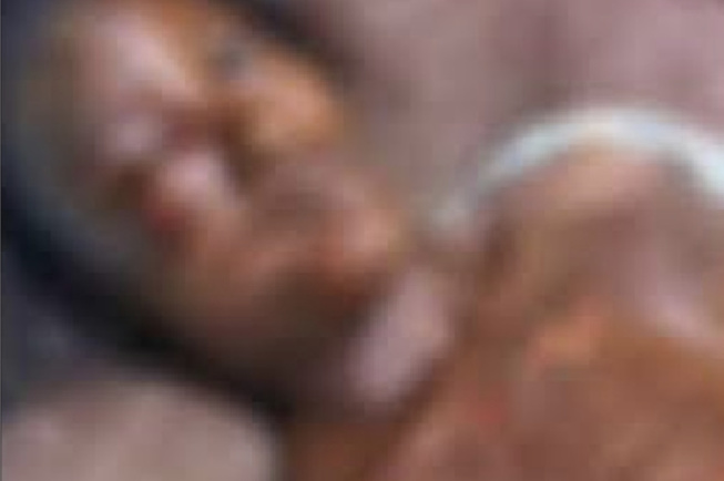 Ebouillantée par sa belle-sœur Soda Guèye et complètement défigurée après son accouchement Ebouillantée par sa belle-sœur Soda Guèye et complètement défigurée après son accouchement