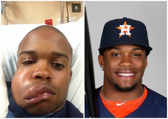 Prendre une balle de base ball à 145km/h ça change un homme Prendre une balle de base ball à 145km/h ça change un homme