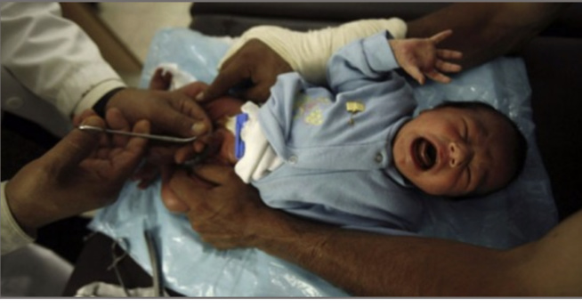Sébikotane: Un bébé décède après une circoncision ratée Sébikotane: Un bébé décède après une circoncision ratée