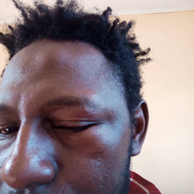 Apr Congo Brazza: L'argent des législatives commence à "parler" entre responsables et jeunesse Mackyiste, sur fond de violence Apr Congo Brazza: L'argent des législatives commence à "parler" entre responsables et jeunesse Mackyiste, sur fond de violence