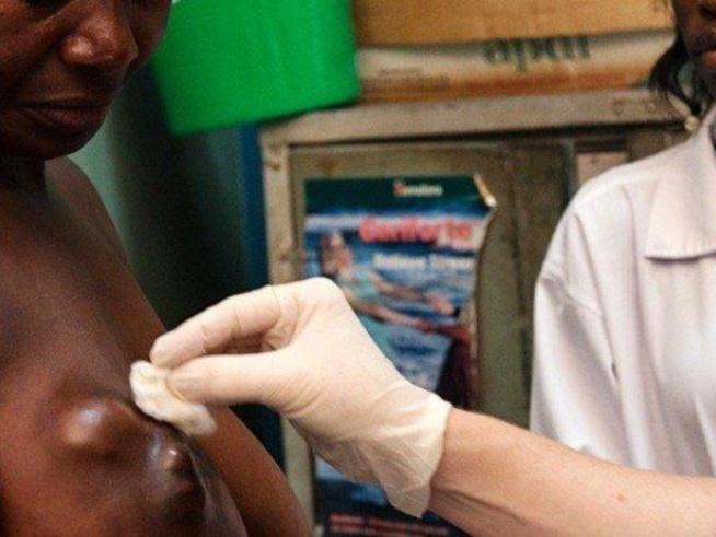 Dépistage au niveau de la région de Diourbel : 19 femmes atteintes de cancer du sein
