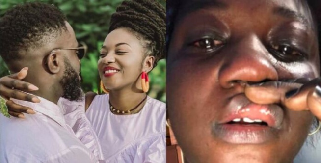 Mia des « Maabo » sauvagement battue par son ex mari ? Les images qui choquent Mia des « Maabo » sauvagement battue par son ex mari ? Les images qui choquent