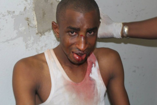 URGENT: Ucad :Bassirou Faye l'étudiant touché par balle succombe à ses blessures (IMAGES) URGENT: Ucad :Bassirou Faye l'étudiant touché par balle succombe à ses blessures (IMAGES)