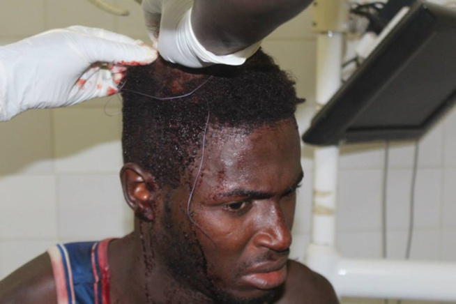 URGENT: Ucad :Bassirou Faye l'étudiant touché par balle succombe à ses blessures (IMAGES) URGENT: Ucad :Bassirou Faye l'étudiant touché par balle succombe à ses blessures (IMAGES)