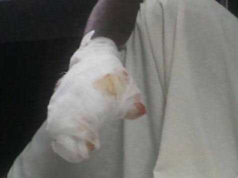 (Photo) Un étudiant forcé à tenir une bombe lacrymogène par un policier (Photo) Un étudiant forcé à tenir une bombe lacrymogène par un policier