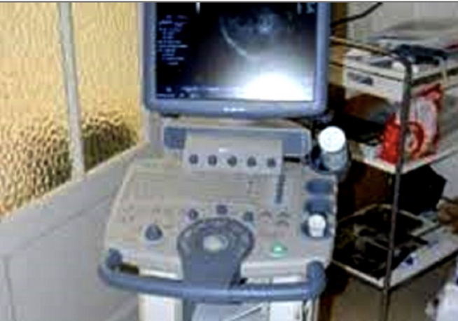 Bambey - fin du calvaire des femmes de Lambaye : L’association des émigrés équipe le poste de santé d’un échographe Bambey - fin du calvaire des femmes de Lambaye : L’association des émigrés équipe le poste de santé d’un échographe