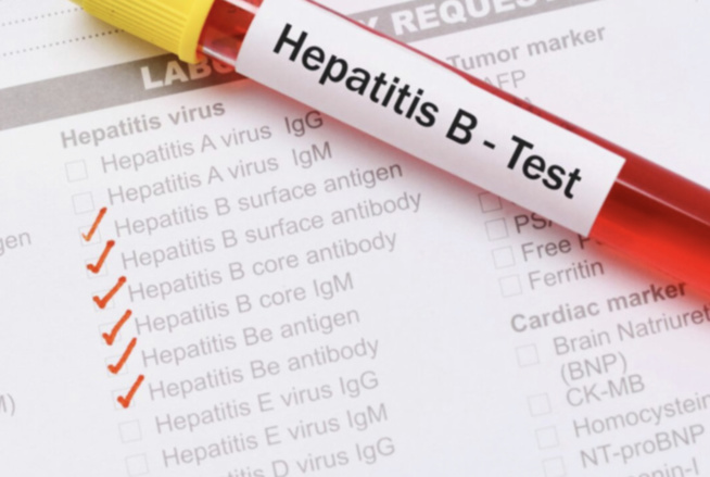 Passy : L’hépatite B à l’origine de la mort de 80% des jeunes (Pharmacien) Passy : L’hépatite B à l’origine de la mort de 80% des jeunes (Pharmacien)