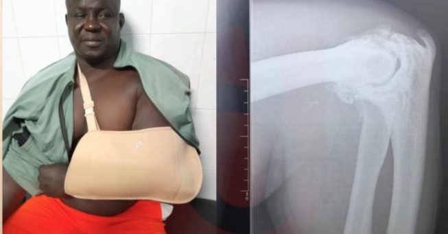 EXCLUSIF!!! LES TRISTES IMAGES DE BOMBARDIER à L’HOPITAL EXCLUSIF!!! LES TRISTES IMAGES DE BOMBARDIER à L’HOPITAL