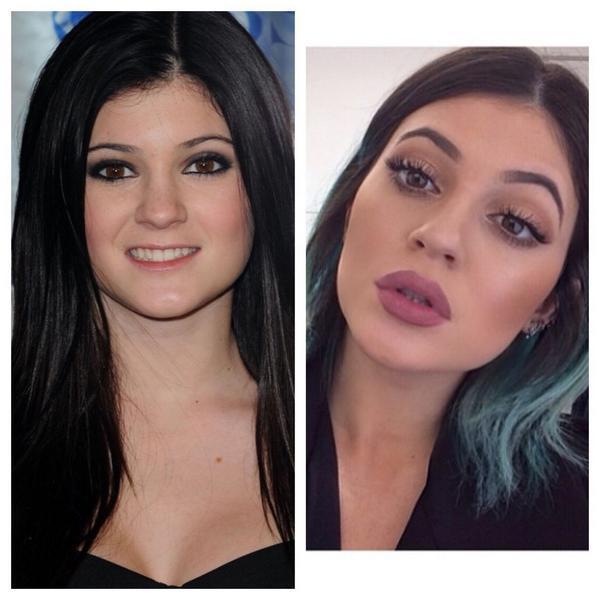 Comment Kim Kardashian explique les lèvres gonflées de sa petite soeur Comment Kim Kardashian explique les lèvres gonflées de sa petite soeur