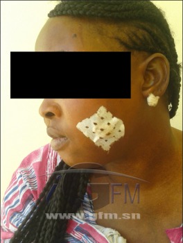 Images: Un journaliste bien connu bastonne et défigure sa 1ére femme en complicité avec sa «niaréél». Regarder Images: Un journaliste bien connu bastonne et défigure sa 1ére femme en complicité avec sa «niaréél». Regarder