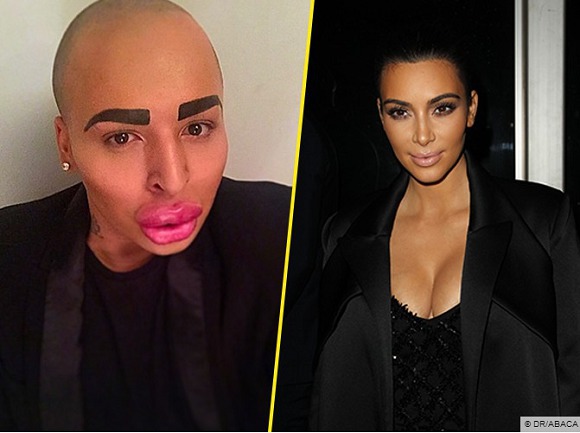 - Kim Kardashian : un homme dépense 150 000 dollars pour tenter de lui ressembler ! - Kim Kardashian : un homme dépense 150 000 dollars pour tenter de lui ressembler !