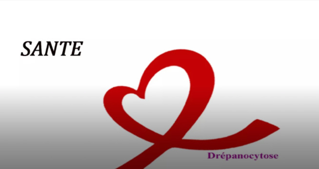 Drépanocytose : environ 2.000 enfants naissent chaque année avec la maladie Drépanocytose : environ 2.000 enfants naissent chaque année avec la maladie