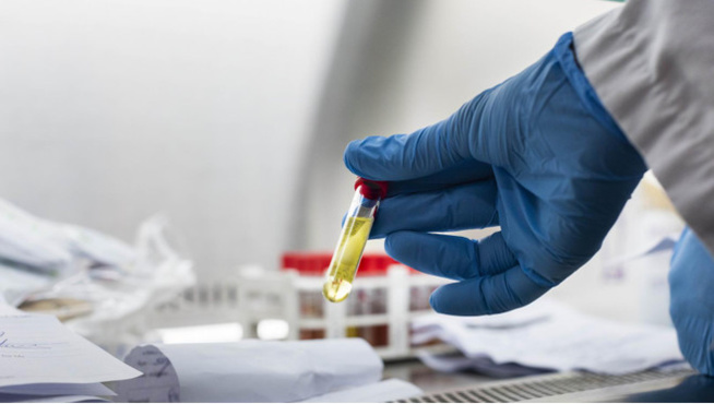 Lutte contre les pandémies: Madiaw Fara Diaw, grand précurseur et exemple d’abnégation Lutte contre les pandémies: Madiaw Fara Diaw, grand précurseur et exemple d’abnégation