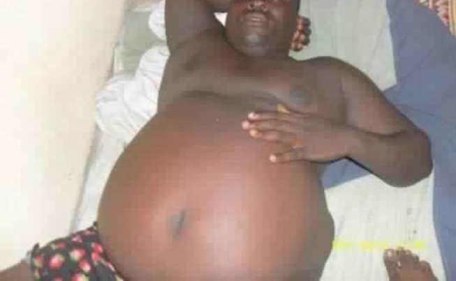 "A cause de son gros ventre, on n’arrive plus à faire l’amour. Je veux divorcer" "A cause de son gros ventre, on n’arrive plus à faire l’amour. Je veux divorcer"