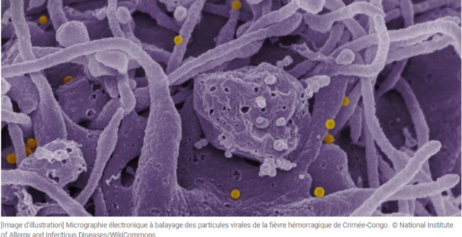 Matam : Un cas de fièvre hémorragique Crimée-Congo découvert à Bokidiawé (Médecin-chef) Matam : Un cas de fièvre hémorragique Crimée-Congo découvert à Bokidiawé (Médecin-chef)