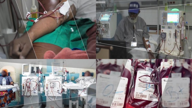 Dossier Spécial Dialyse : "Les malades meurent comme des mouches pour non-assistance" Dossier Spécial Dialyse : "Les malades meurent comme des mouches pour non-assistance"