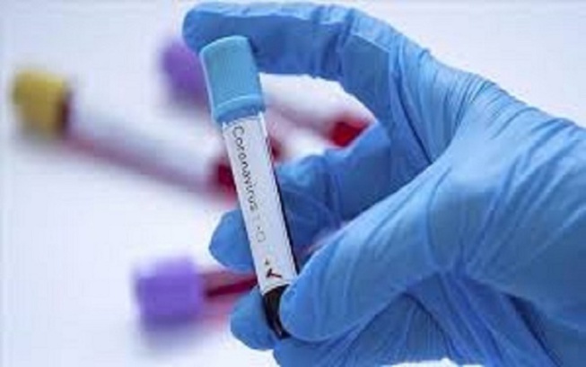 Alerte Sante - Hajj : un taux de positivité au coronavirus de 20% à 60% chez les pèlerins de retour d’Arabie Saoudite (médecin)