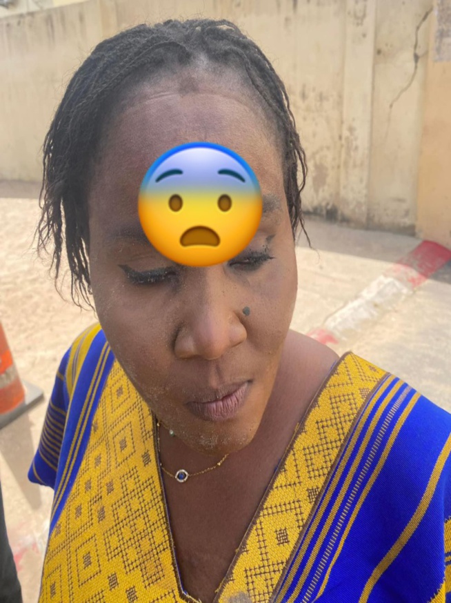 La journaliste Maty Sarr Niang attaquée et blessée La journaliste Maty Sarr Niang attaquée et blessée