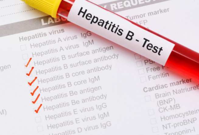 Lutte contre les hépatites au Sénégal : Les acteurs s’attaquent à la transmission de la mère à l’enfant Lutte contre les hépatites au Sénégal : Les acteurs s’attaquent à la transmission de la mère à l’enfant