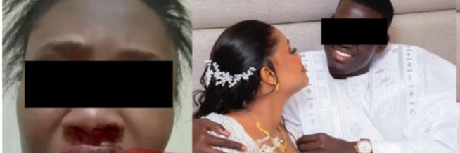 🚨Urgent / Diayna, victime de violences : Son mari Alioune Mbacké Badara livre sa version des faits 🚨Urgent / Diayna, victime de violences : Son mari Alioune Mbacké Badara livre sa version des faits