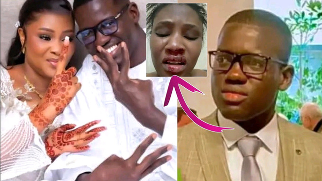 Tribunal de Matam : Docteur Mbacké condamné à 45 jours de prison ferme… Tribunal de Matam : Docteur Mbacké condamné à 45 jours de prison ferme…