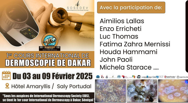 La dermoscopie à l'honneur au Sénégal – Une formation scientifique de haut niveau à Saly La dermoscopie à l'honneur au Sénégal – Une formation scientifique de haut niveau à Saly
