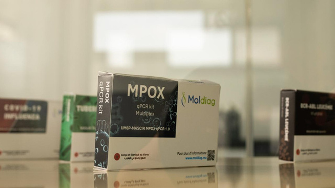 L’OMS lève l’urgence sanitaire mondiale sur Mpox : fin de l’alerte internationale, mais la vigilance reste requise L’OMS lève l’urgence sanitaire mondiale sur Mpox : fin de l’alerte internationale, mais la vigilance reste requise