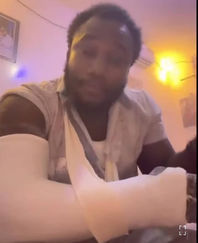 Bagarre entre influenceurs de Pastef: le bras de Assane Gueye alias Azoura Fallou fracturé