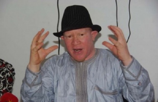Sorcellerie, Mouhamadou Bamba Diop : «Je me demande si les albinos ne doivent pas quitter le Sénégal». Sorcellerie, Mouhamadou Bamba Diop : «Je me demande si les albinos ne doivent pas quitter le Sénégal».
