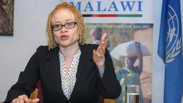 Au Malawi, les albinos menacés d’extermination par la sorcellerie - L'Onu s'en inquiète Au Malawi, les albinos menacés d’extermination par la sorcellerie - L'Onu s'en inquiète