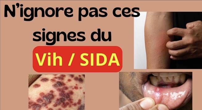 Contact avec une personne vivant avec le VIH : Que faire concrètement et sans paniquer ?