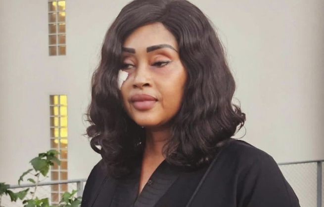 Blessée en mission, la députée Maimouna Bousso envoie un message à Ousmane Sonko et Bassirou Diomaye Faye