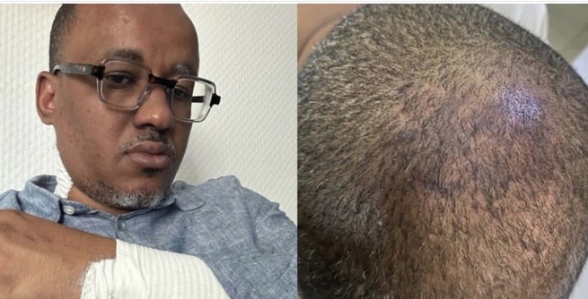 Tribunal de Pikine-Guédiawaye : Oumar Sow porte plainte avec constitution de partie civile pour « actes de torture » Tribunal de Pikine-Guédiawaye : Oumar Sow porte plainte avec constitution de partie civile pour « actes de torture »
