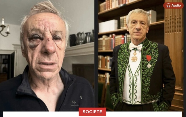 Une vraie boucherie » : L'ancien ambassadeur de France au Sénégal, Jean-Christophe Rufin, raconte son agression Une vraie boucherie » : L'ancien ambassadeur de France au Sénégal, Jean-Christophe Rufin, raconte son agression