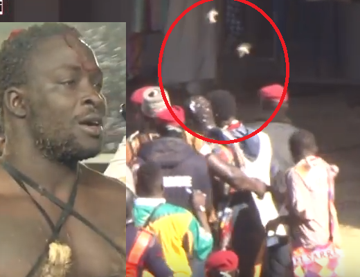 Siteu a lutté avec la tête fracassée par ses supporters: le sang coule sa tête …Regardez la vidéo qui montre tout