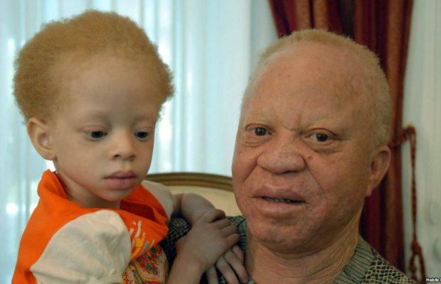 Djéneba Diarra Une jeune albinos assassinée et son corps décapité à l’approche des élections