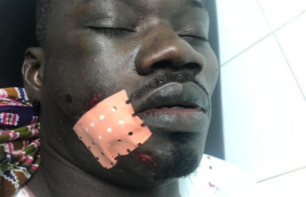Urgent : Guin Thieuss sauvagement agressé…