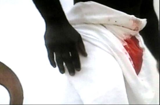 Elle mord l’appareil de son mari parce qu’il…