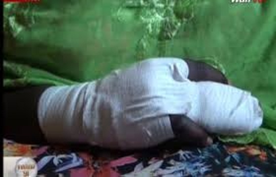Pape Cheikh Coulibaly échappe à la mort , le doigt de son agresseur retrouvé sur la scène de l’agression