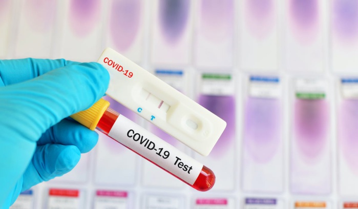 Covid 19:Le ministère de la Santé arrête les tests sur les cas contacts...