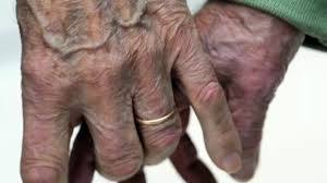 Maladie d'Alzheimer : pour les proches, un quotidien transformé en "enfer"