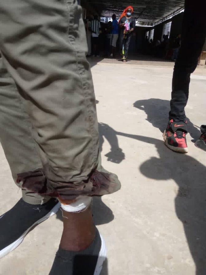 Affrontements à l'Ucad: un étudiant prend une balle dans la jambe, la lutte se poursuit aujourd'hui