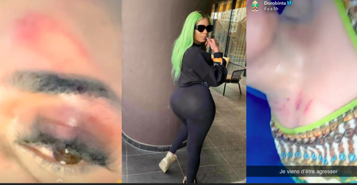 Ch0c : La jet setteuse Doro Binta sauvagement agressée à Dakar… âmes sensibles s’abstenir ! Li niaw na